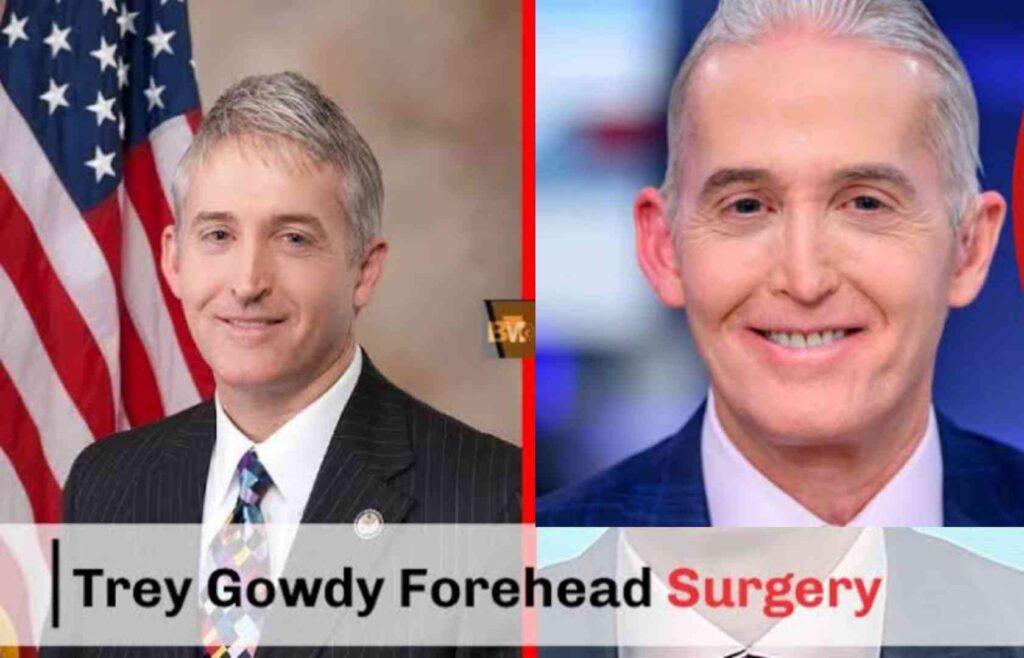 Trey Gowdy Forehead Surgery